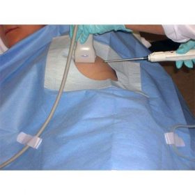 Disposable Surgical Drape 650mm X 650mm