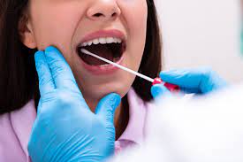 Throat Swabs - White